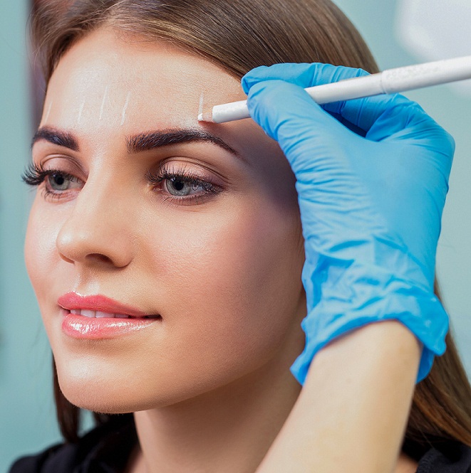 BROW LIFT SURGERY