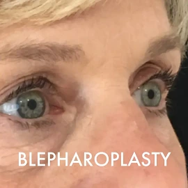 Cosmetic Surgery Clinic cost uk