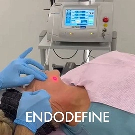 Endolift